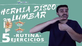 Tratamiento de la hernia discal L5 y S1 derecha o quinta lumbar y sacro [upl. by Stickney]