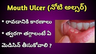 Mouth Ulcers Reasons and Treatment in Telugu [upl. by North]