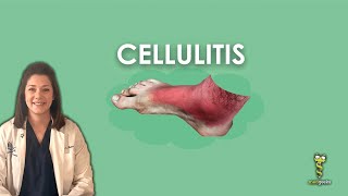 Cellulitis [upl. by Earlie]