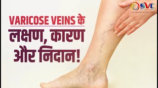 VARICOSE VEINS  SYMPTOMS  CAUSES  TREATMENTS  VARICOSE VEINS SPECIALIST [upl. by Nagel]