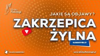 ZAKRZEPICA ŻYLNA  jakie są jej objawy [upl. by Einnoc]