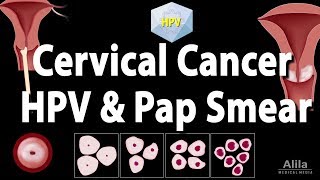 Pap smear test in Hindi [upl. by Kjersti534]