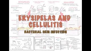 Bacterial Skin Infection  Cellulitis and Erysipelas Clinical Presentation Pathology Treatment [upl. by Orran]