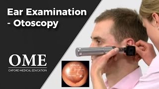 Otoscopy Ear Examination  ENT [upl. by Marder424]