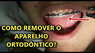 Como remover aparelho  resumido passo a passo [upl. by Eilram]