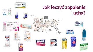 Jak leczyć zapalenie ucha [upl. by Agnizn]