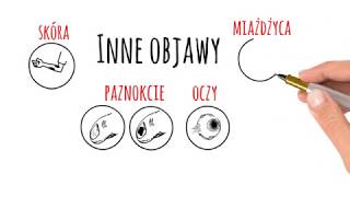 SKN Reumatologii Łuszczycowe Zapalenie Stawów ŁZS [upl. by Vish]