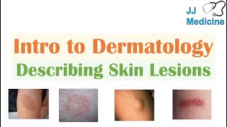 Introduction to Dermatology  The Basics  Describing Skin Lesions Primary amp Secondary Morphology [upl. by Hachmin277]