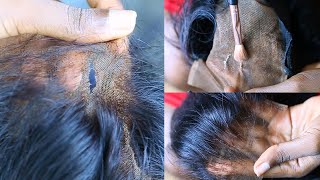 How To Fast amp Easy Fix A TORN Or RIPPED Lace ClosureFrontal Wig With Extra Tips Headmistress [upl. by Rayford589]