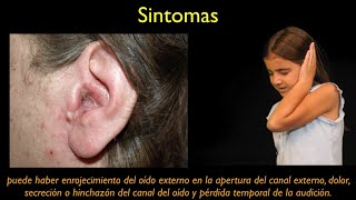 otitis externa ESPANOL [upl. by Akerdnahs]