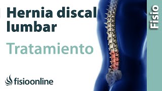 Hernia Discal Mejores Ejercicios Eliminar el Dolor Lumbar y la Ciática [upl. by Eelrefinnej]