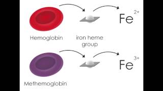 Hemoglobin Problems  Methemoglobinemia [upl. by Piefer664]