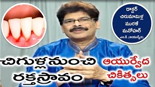 Bleeding Gums Causes and Ayurvedic Treatment in Telugu by Dr Murali Manohar Chirumamilla MD [upl. by Red722]