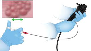 Endoscopy Technology TheoryLesson 11Handling Accessories [upl. by Asiral]