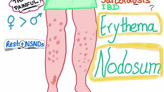 Erythema Nodosum [upl. by Ortiz]