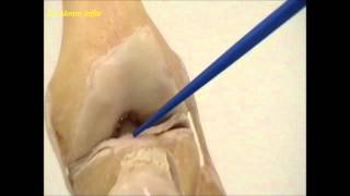 Anatomy of the knee joint [upl. by Ylra]