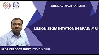 Lesion segmentation in Brain MRI [upl. by Naxela234]