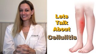 CELLULITIS Everything You Need To Know Symptoms Cause Risk Factors Treatment Prevention [upl. by Attey]