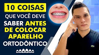 10 COISAS QUE VOCÃŠ DEVE SABER ANTES DE COLOCAR APARELHO ORTODÃ”NTICO [upl. by Ellatnahc]