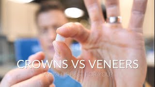 CROWNS VS VENEERS  Which is best [upl. by Licec40]