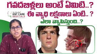 గవదబిళ్లలు అంటే ఏమిటి  Acute Parotitis or Mumps in Telugu  Dr Harika ENT Care Hospital [upl. by Atiuqcaj]