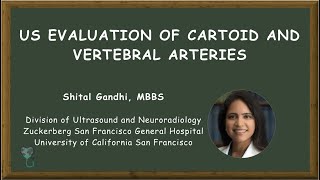 HowToPerform Carotid Doppler Step3 Vertebral artery [upl. by Stieglitz]