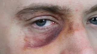 Black Eye Makeup SFX Beginners Tutorial [upl. by Kelton466]