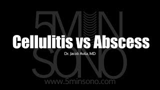 Differentiating Cellulitis from Abscess with POCUS [upl. by Eiahpets]