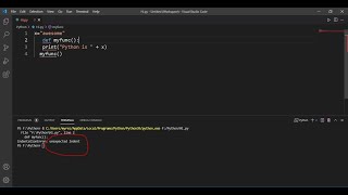 IndentationError unexpected indent Problem Solve Python VSCODE [upl. by Nevuer175]