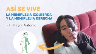 Diferencias entre la hemiplejia izquierda y hemiplejia derecha Explicado con EJEMPLOS [upl. by Nylssej54]