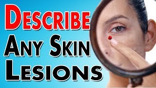 Describing Skin Lesions [upl. by Eugen6]