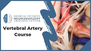 Vertebral Artery Course [upl. by Cherilyn]