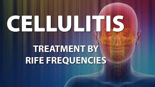 Cellulitis Bacterial infection  RIFE Frequencies Treatment  Energy amp Quantum Medicine [upl. by Hendren]