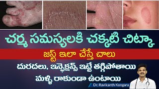 How to Get Relief from Itching  Parasitic Infection  Albendazole Tablets  DrRavikanth Kongara [upl. by Anatak]