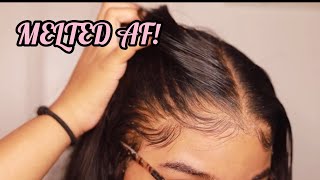 How to RE Install Frontal Wigs for Beginners  VERY DETAILED  Melt Transparent Lace [upl. by Aerdnaz]