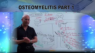 Osteomyelitis  Causes amp Symptoms  Bone Infection🩺 [upl. by Kassey]