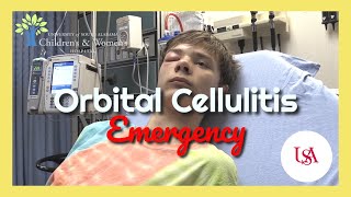 Orbital Cellulitis Emergency [upl. by Jacquetta]