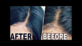 How To quotHIDE LACEquot amp Wig Cap Lace Wigs Fake Scalp Method  ORIGINAL CREATOR [upl. by Odnaloy]