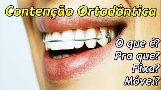 Explicando o que é a Contenção Ortodôntica [upl. by Terza]