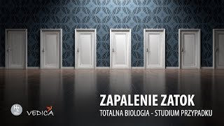 ZAPALENIA ZATOK  Totalna Biologia  Studium przypadku [upl. by Aisauqal200]