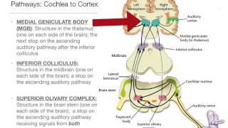 Perception101  The Auditory Brain [upl. by Amory961]