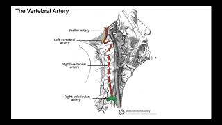 Cerebral angiography 14 [upl. by Larentia716]