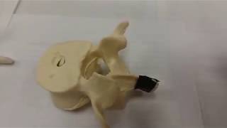 Typical Vertebra Parts 1 of 2 [upl. by Bagger460]