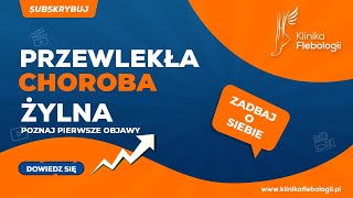 Przewlekła choroba żylna  pierwsze objawy [upl. by Caprice222]