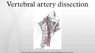 VERTEBRAL COLUMN ANATOMY 12 [upl. by Romona543]