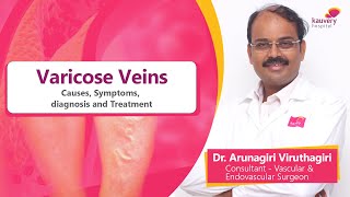 Varicose Veins Causes  Symptoms Diagnosis and Treatment  Tamil [upl. by Einnahpets]