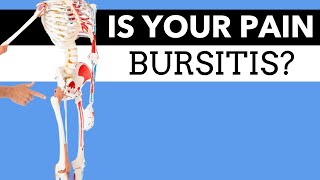 Iliopsoas Syndrome Bursitis amp Tendonitis  why Prolotherapy can help plateaued chronic cases [upl. by Acherman950]