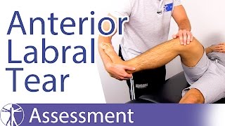 Anterior Labral Tear Test⎟Labral Tear [upl. by Iderf]