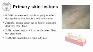 4 Primary and Secondary skin lesions [upl. by Nylcsoj]